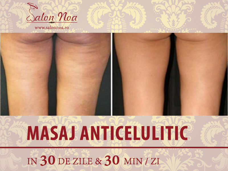 Salon masaj anticelulitic